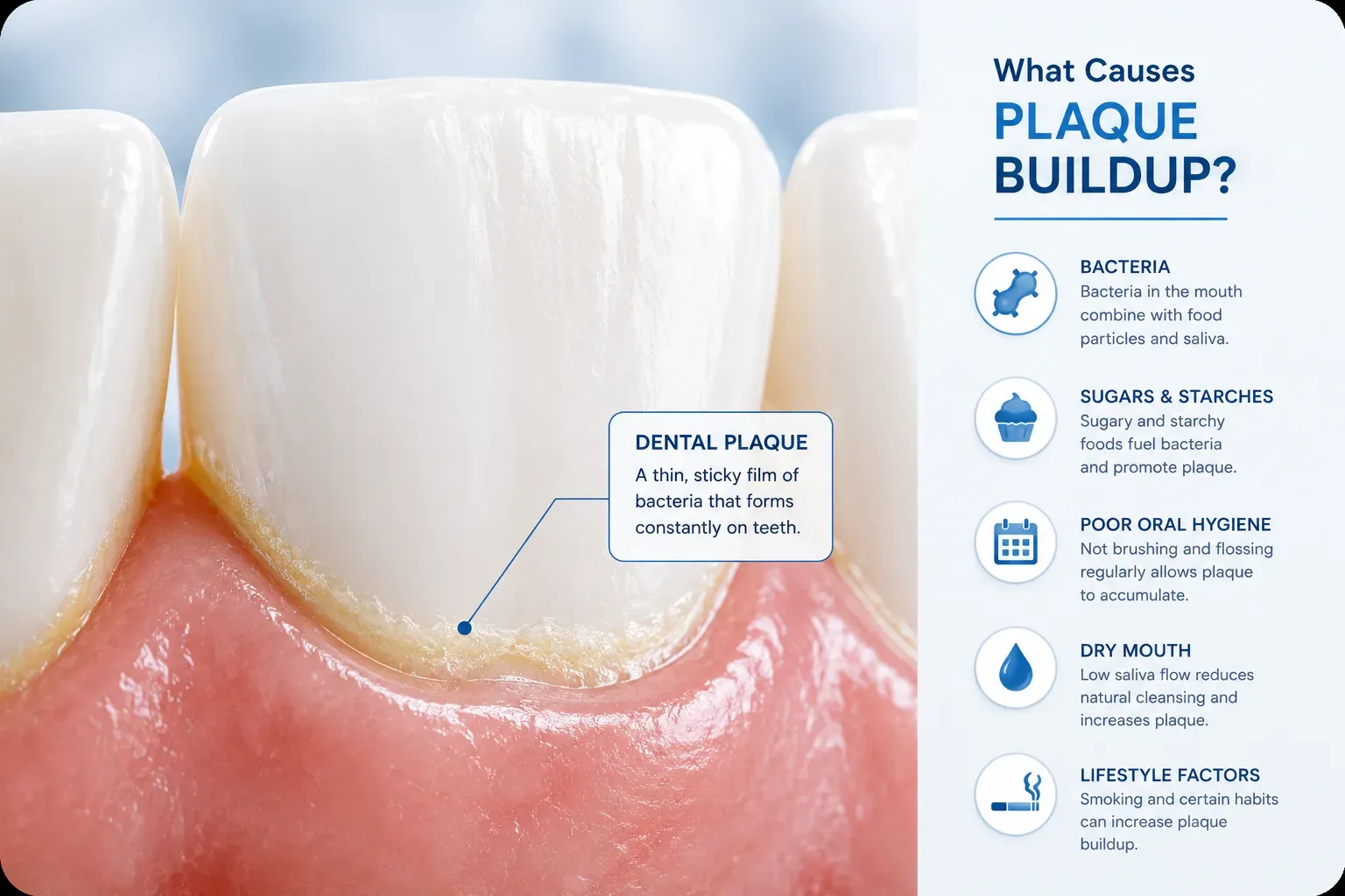 What Causes Plaque Buildup (And Why It Keeps Coming Back)