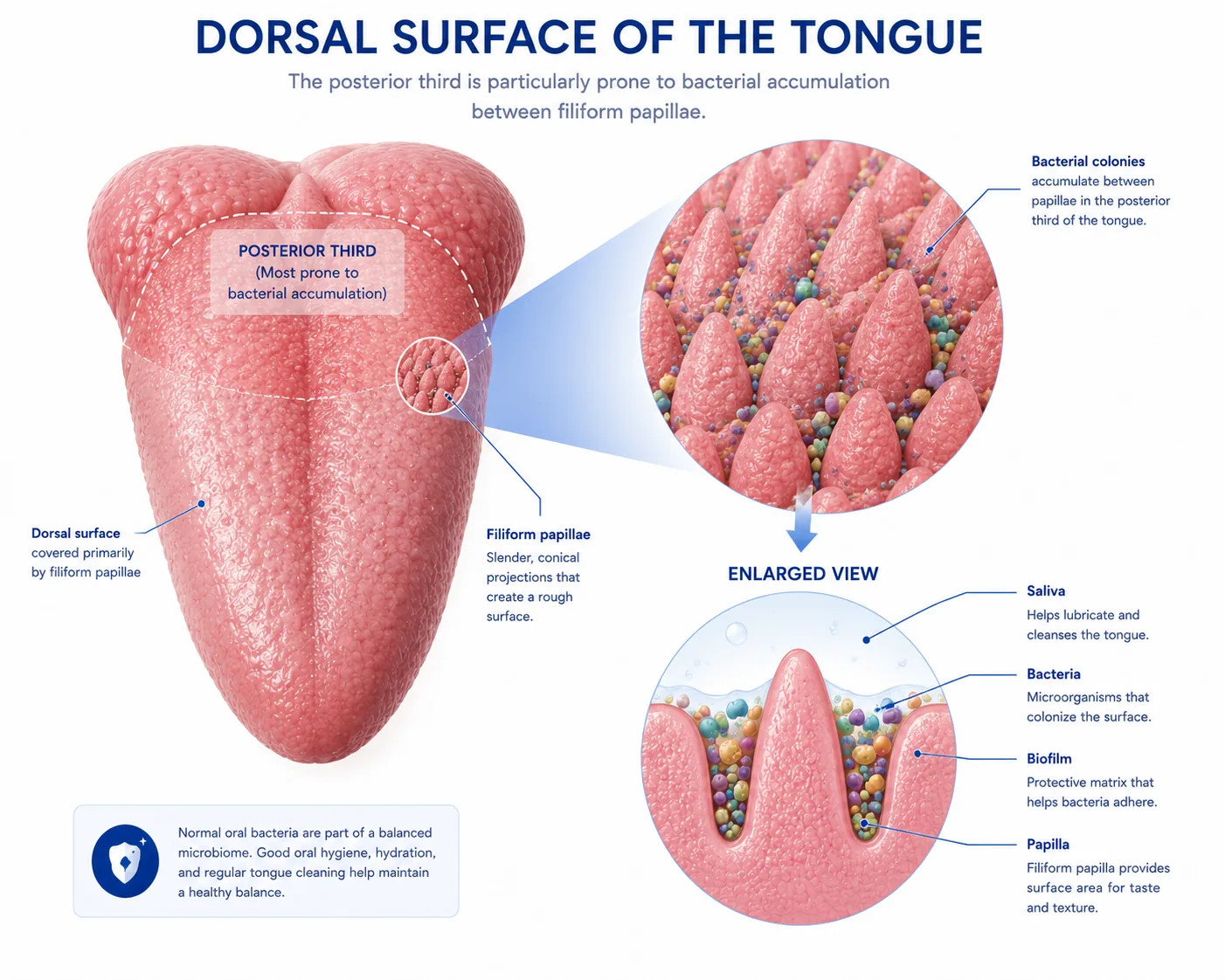 Illustration of a tongue profile highlighting the bacterial coating on the back third compared to the cleaner front surface