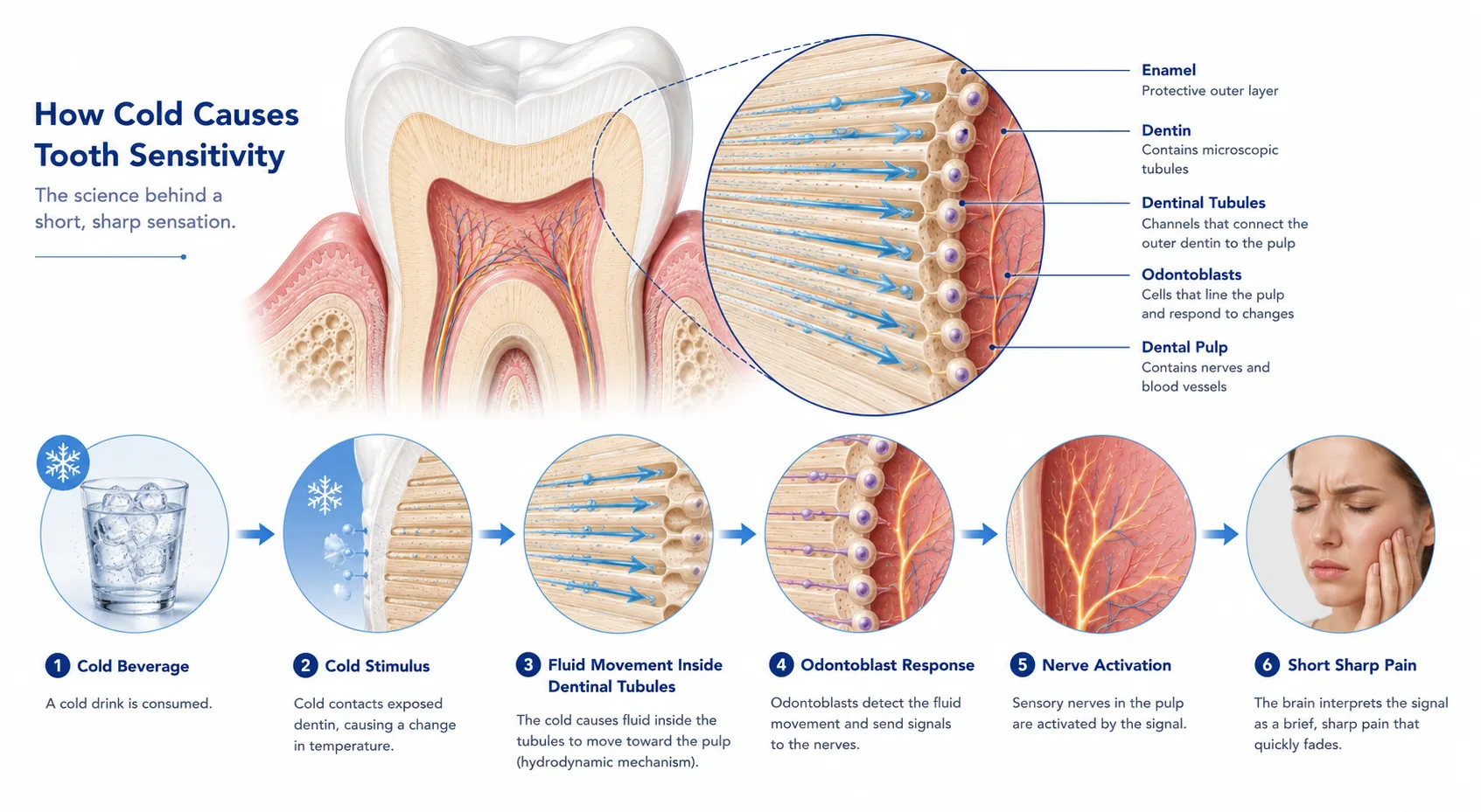 Illustration of a slightly mobile tooth surrounded by inflamed gum tissue, with arrows showing the splinting process of bonding it to neighboring teeth with a thin wire